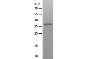 Western Blotting (WB) image for Interleukin 8 (IL8) (AA 26-167) protein (His-IF2DI Tag) (ABIN7123621)