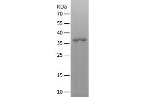 IL-8 Protein (AA 26-167) (His-IF2DI Tag)