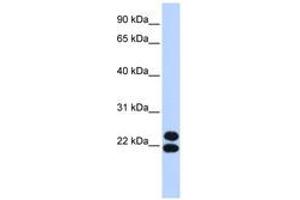 Image no. 1 for anti-Paired Related Homeobox 2 (PRRX2) (AA 35-84) antibody (ABIN6742837) (PRRX2 anticorps  (AA 35-84))