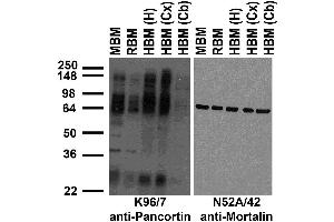Immunoblot against crude membrane fractions from whole mouse (MBM) or rat (RBM) brain and from human hippocampus [HBM(H)], cerebral cortex [HBM(Cx)] or cerebellum [HBM(Cb)] and probed with K96/7 (left) or N52A/42 (right) TC supe.