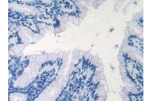 Detection of NOS1 in Mouse Colon Tissue using Polyclonal Antibody to Nitric Oxide Synthase 1, Neuronal (NOS1)