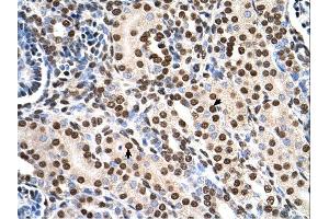 RSU1 antibody was used for immunohistochemistry at a concentration of 4-8 ug/ml. (RSU1 anticorps  (C-Term))