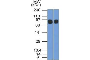 Western Blot (1) Raji and (2) Ramos cell lysates using CD10 Mouse Monoclonal Antibody (MME/1892).
