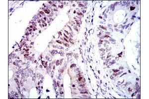 Immunohistochemistry (IHC) image for anti-Cyclin-Dependent Kinase 2 (CDK2) antibody (ABIN1845617) (CDK2 anticorps)