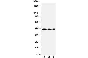 Western blot testing of AQP2 antibody and Lane 1:  MCF-7;  2: SW620;  3: HT1080 cell lysate. (AQP2 anticorps  (AA 245-260))