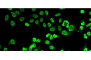 Immunofluorescence analysis of A-549 cells using FIP1L1 Polyclonal Antibody