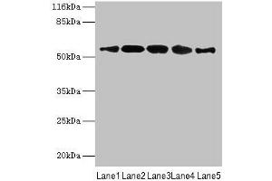 Western blot All lanes: VIPAS39 antibody at 12 μg/mL Lane 1: HepG2 whole cell lysate Lane 2: A431 whole cell lysate Lane 3: 293T whole cell lysate Lane 4: Mouse kidney tissue Lane 5: Hela whole cell lysate Secondary Goat polyclonal to rabbit IgG at 1/10000 dilution Predicted band size: 58, 52 kDa Observed band size: 58 kDa (VIPAR anticorps  (AA 1-493))