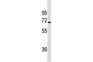 CYP1A2 antibody western blot analysis in SK-BR-3 lysate.