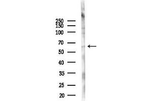 Western blot analysis of lysates from PC12 cells(UV 30 min treatment), using SQSTM1/p62 Antibody at 1/1000 dilution.