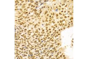 Immunohistochemistry (IHC) image for anti-Dyskeratosis Congenita 1, Dyskerin (DKC1) (AA 245-514) antibody (ABIN1512829) (DKC1 anticorps  (AA 245-514))