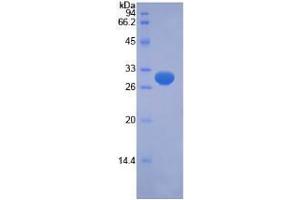 SDS-PAGE analysis of Human PINK1 Protein. (PINK1 Protéine)