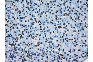 Immunohistochemical staining of paraffin-embedded lung tissue using anti-ERCC1 mouse monoclonal antibody. (ERCC1 anticorps)