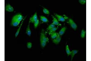 Immunofluorescence staining of Hela cells with ABIN7148543 at 1:133, counter-stained with DAPI.