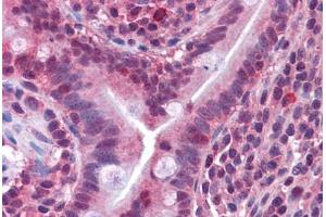 Human Small Intestine: Formalin-Fixed, Paraffin-Embedded (FFPE)