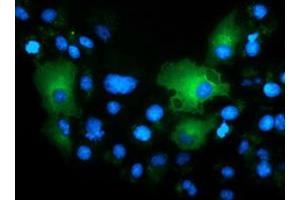 Anti-TCP11L2 mouse monoclonal antibody (ABIN2453718) immunofluorescent staining of COS7 cells transiently transfected by pCMV6-ENTRY TCP11L2 (RC207129). (TCP11L2 anticorps)