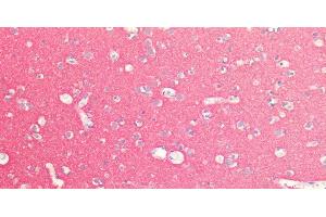 anti-Synaptosomal-Associated Protein, 25kDa (SNAP25) antibody