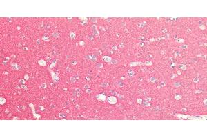 Immunohistochemistry of paraffin-embedded Human Brain using SNAP25 Polyclonal Antibody at dilution of 1:100.