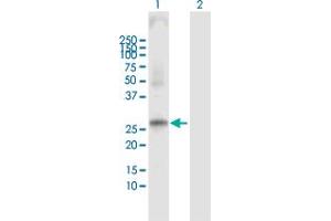 Western Blot analysis of PRSS1 expression in transfected 293T cell line by PRSS1 MaxPab polyclonal antibody. (PRSS1 anticorps  (AA 1-247))
