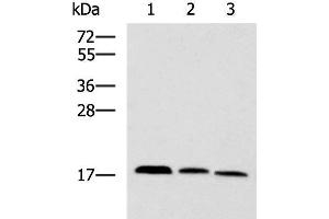 Western blot analysis of Mouse kidney tissue Rat brain tissue Mouse liver tissue lysates using CPLX3 Polyclonal Antibody at dilution of 1:950 (CPLX3 anticorps)