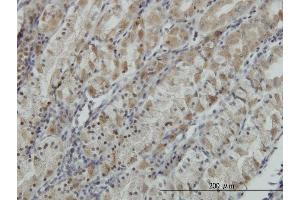 Immunoperoxidase of monoclonal antibody to ATP6V0D1 on formalin-fixed paraffin-embedded human stomach.