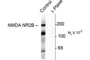Image no. 1 for anti-Glutamate Receptor, Ionotropic, N-Methyl D-Aspartate 2B (GRIN2B) (pTyr1472) antibody (ABIN372687) (GRIN2B anticorps  (pTyr1472))