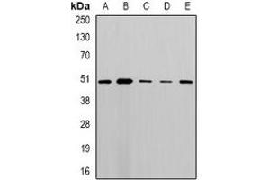 Western blot analysis of MLN64 expression in MCF7 (A), A549 (B), mouse lung (C), mouse heart (D), rat brain (E) whole cell lysates. (STARD3 anticorps)