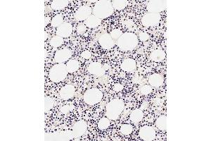 Immunohistochemical analysis of paraffin-embedded Human marrow tissue using A performed on the Leica® BOND RXm. (TAL1 anticorps  (AA 68-97))
