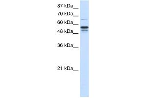 WB Suggested Anti-FOXG1B Antibody Titration:  1. (FOXG1 anticorps  (N-Term))