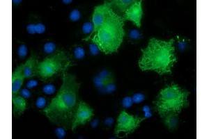 Anti-CALCOCO2 mouse monoclonal antibody (ABIN2453913) immunofluorescent staining of COS7 cells transiently transfected by pCMV6-ENTRY CALCOCO2 (RC203843). (CALCOCO2 anticorps)