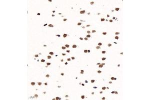 Immunohistochemistry of paraffin embedded rat brain using ZNF682 (ABIN7076270) at dilution of 1:1200 (400x lens) (ZNF682 anticorps)