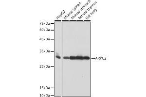 Western blot analysis of extracts of various cell lines, using  antibody (ABIN7265385) at 1:1000 dilution. (ARPC2 anticorps)