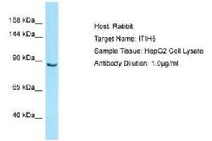 Image no. 1 for anti-Inter alpha Globulin Inhibitor H5 (ITIH5) (AA 77-126) antibody (ABIN6750010)