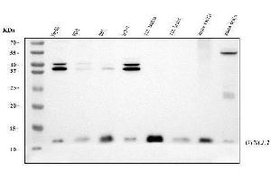 Western blot analysis of DYNLL1/PIN using anti-DYNLL1/PIN antibody (ABIN7599570).