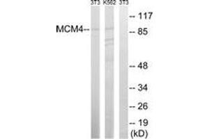 Western blot analysis of extracts from NIH-3T3/K562 cells, using MCM4 (Ab-54) Antibody. (MCM4 anticorps  (AA 20-69))
