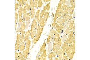 Immunohistochemistry of paraffin-embedded rat heart using CA3 antibody at dilution of 1:100 (x400 lens). (CA3 anticorps)