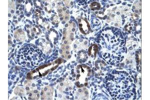 Image no. 1 for anti-Ts Translation Elongation Factor, Mitochondrial (TSFM) (AA 76-125) antibody (ABIN6735975)