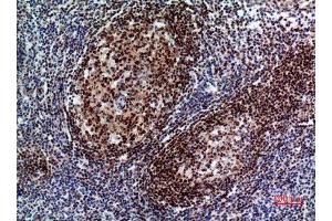 Immunohistochemistry (IHC) analysis of paraffin-embedded Human Tonsil, antibody was diluted at 1:100. (PAX5 anticorps  (Internal Region))