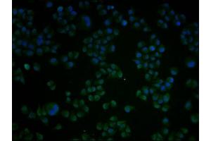 Immunofluorescence staining of Hela cells with ABIN7148793 at 1:100, counter-stained with DAPI. (ATF4 anticorps  (AA 20-200))