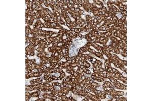 Immunohistochemical staining of human liver with TAS2R60 polyclonal antibody  shows cytoplasmic positivity in hepatocytes at 1:50-1:200 dilution. (TAS2R60 anticorps)