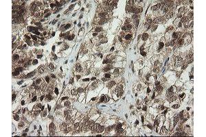 Image no. 8 for anti-Phosphoinositide-3-Kinase, Catalytic, gamma Polypeptide (PIK3CG) antibody (ABIN1500207)