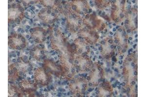 Detection of CAT in Mouse Kidney Tissue using Polyclonal Antibody to Catalase (CAT)