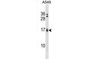 Western Blotting (WB) image for anti-BCL2-Interacting Killer (Apoptosis-Inducing) (BIK) (BH3 Domain) antibody (ABIN2997206)