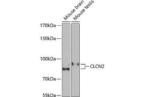 Western blot analysis of extracts of various cell lines, using CLCN2 Antibody (ABIN6133641, ABIN6138663, ABIN6138664 and ABIN6221716) at 1:1000 dilution.