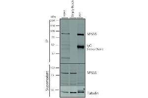 Immunoprecipitation analysis using Mouse Anti-VPS35 Monoclonal Antibody, Clone 7E4 (ABIN6932930).