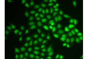 Immunofluorescence analysis of U2OS cells using UBE2V1 antibody. (UBE2V1 anticorps  (AA 1-147))
