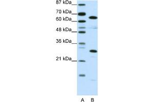 WB Suggested Anti-HMGB4 Antibody Titration:  0. (HMGB4 anticorps  (C-Term))