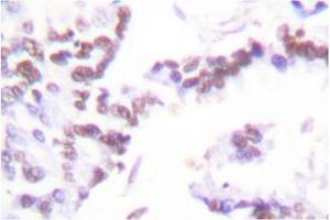 Image no. 2 for anti-Cyclin G1 (CCNG1) antibody (ABIN265382) (Cyclin G1 anticorps)