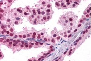 ABIN185022 (3. (FOXA2 anticorps  (C-Term))