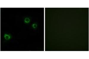 Immunofluorescence analysis of HuvEc cells, using CLDN6 Antibody. (Claudin 6 anticorps  (AA 81-130))