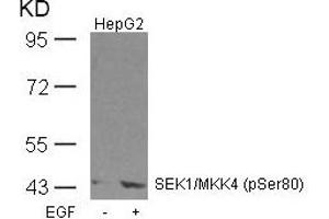 Western blot analysis of extracts from HepG2 cells untreated or treated with EGF using SEK1/MKK4(Phospho-Ser80) Antibody. (MAP2K4 anticorps  (pSer80))
